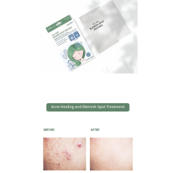 Veraclara Tea Tree Acne Blemish Spot Patch 105 Adet Sivilce Bandı - 3