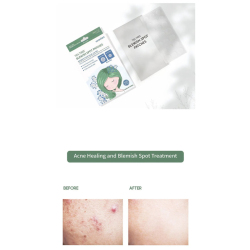 Veraclara Tea Tree Acne Blemish Spot Patch Sivilce Bandı 21 Adet - 2